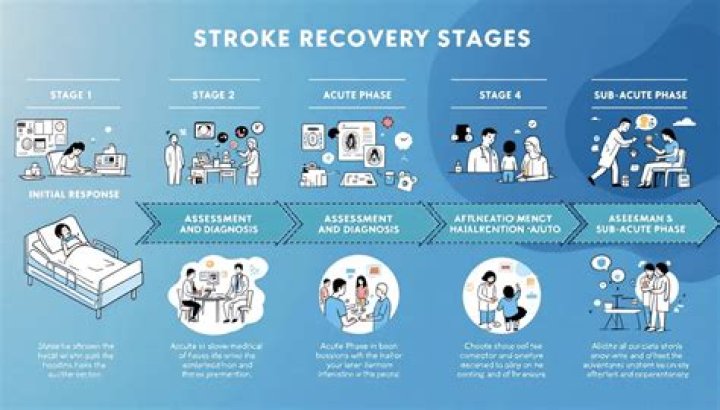 The stages of stroke recovery Brunnstrom stages, recovery time & more