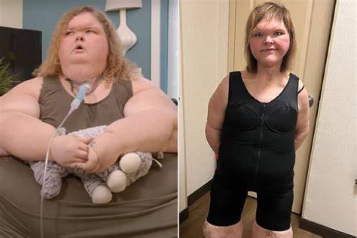 The Transformative Journey Of Tammy From 1000-Lb Sisters: An Inspiring Update