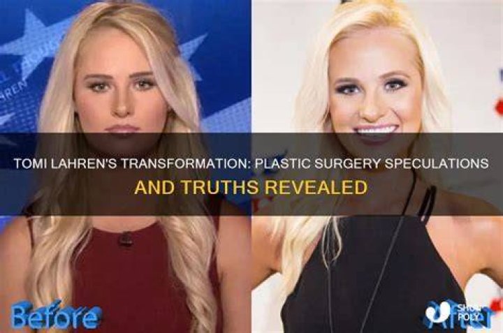 Tomi Lahren's Plastic Surgery Journey Revealed