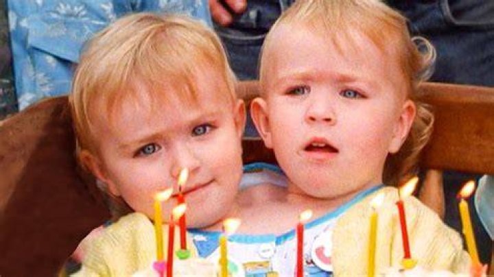 Two Heads, One Body Eilish Holton's Life After Seperating From Her