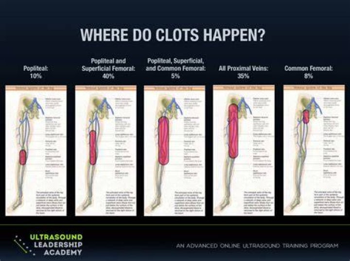 Ultrasound Leadership Academy Lower Extremity DVT — EM Curious