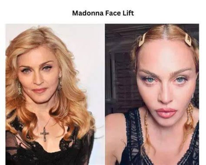 Uncover The Enigmatic World Of Madonna's Beau: Secrets Revealed