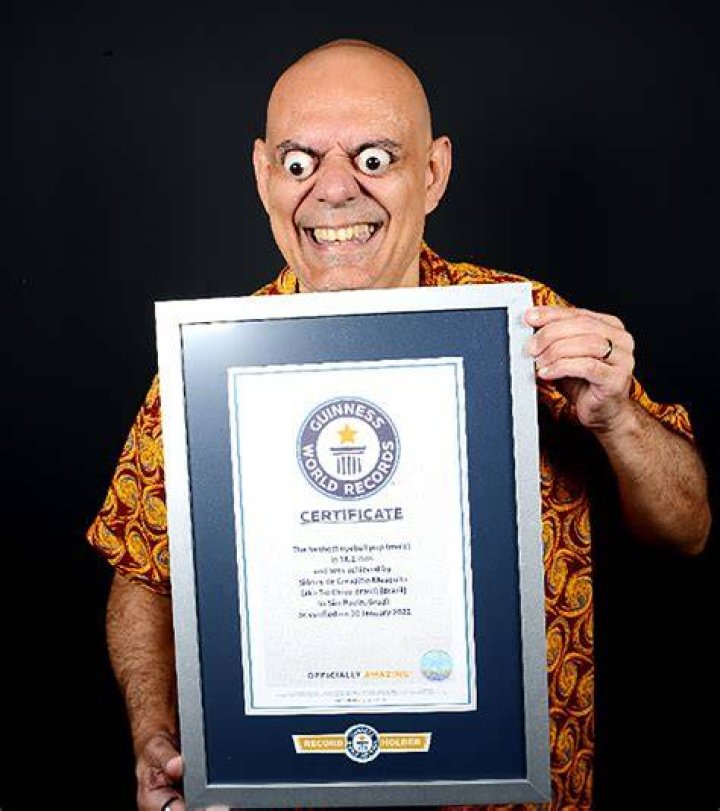 Uncover The Secrets Of The Guinness World Record Ugliest Man
