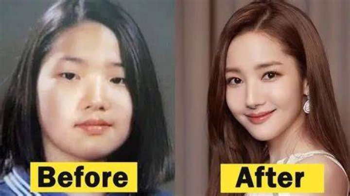Uncover The Truth Behind Park Min Young's Surgery: A Revealing Exploration