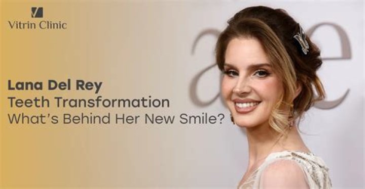 Uncovering The Secrets Behind Her Dental Transformation