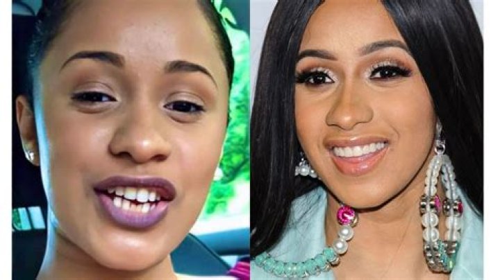 Unlock The Secrets Behind Cardi B's Iconic Smile