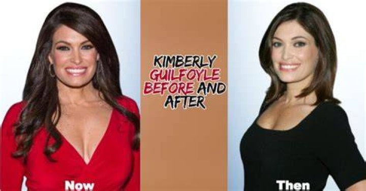 Unlock Youthful Vitality And Confidence: Discover Kimberly Guilfoyle's Transformation