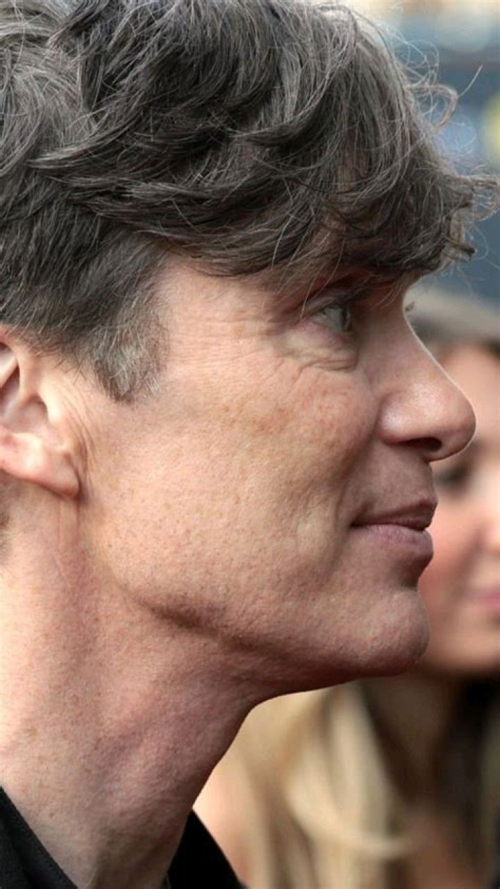 Unlocking The Secrets Of Cillian Murphy's Ear Bump