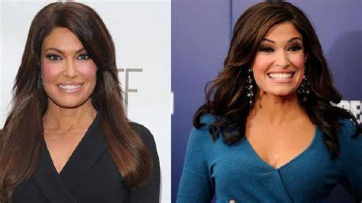 Unveiling Kimberly Guilfoyle's Transformation: Before And After Insights