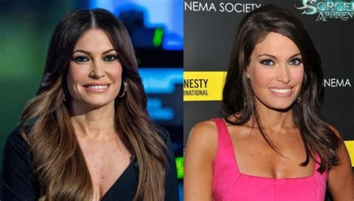 Unveiling The Enigma: Kimberly Guilfoyle's Transformation Exposed