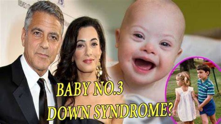 Unveiling The Extraordinary Journey Of George Clooney's Twins With Down Syndrome