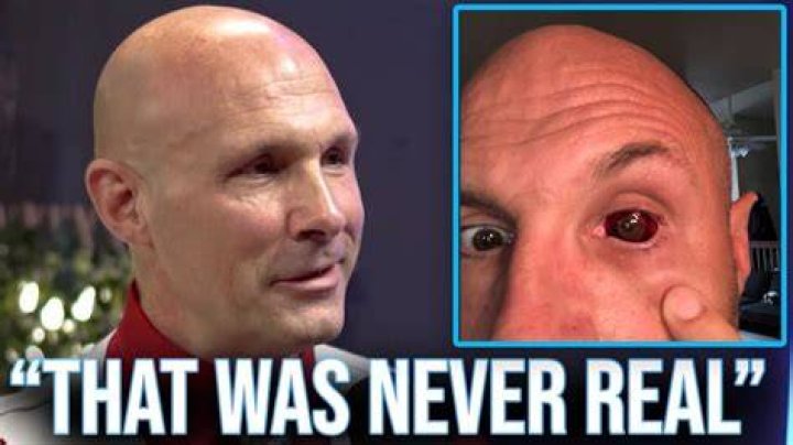 Unveiling The Secrets And Mastery Of Christopher Daniels Eye