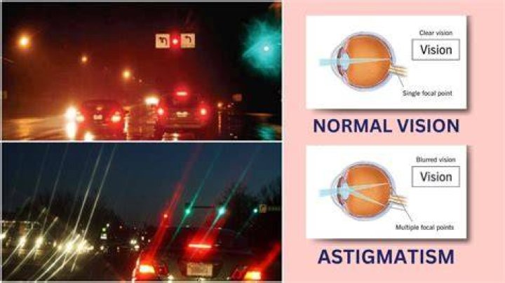Unveiling The Secrets Of Severe Astigmatism At Night: Discoveries And Insights