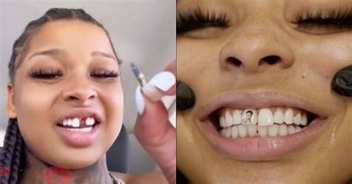 Unveiling The Startling Truth: Chrisean Rock's Lost Tooth