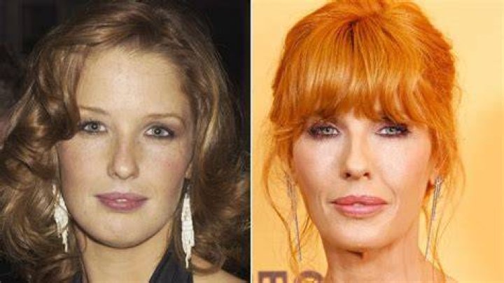 Unveiling The Truth Behind Kelly Reilly's Lip Transformation: A Journey Of Discovery