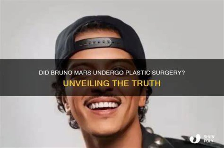 Unveiling The Truth Behind The Rumors: Is Bruno Mars Alive?