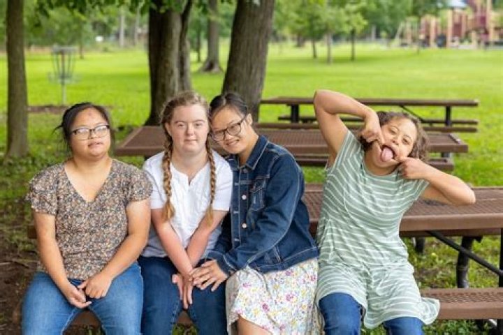 Unveiling The Truths And Triumphs Of Down Syndrome