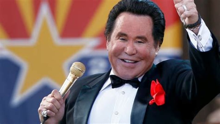 Wayne Newton Face Lift, Did He Get Plastic Surgery?
