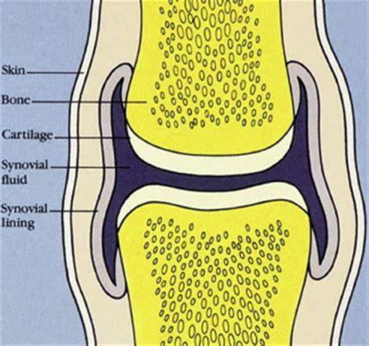What does turbid synovial fluid mean?