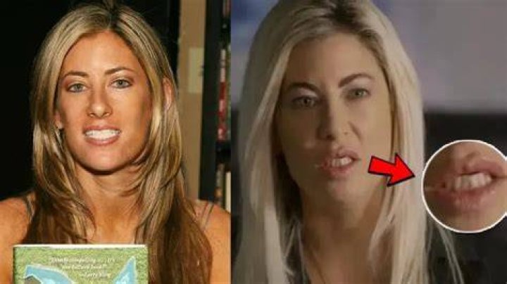 What Happened To Jennifer Saginors Teeth? Meet The Dr. Mark Saginor Daughter On Instagram