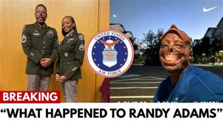 What Happened To Soldier Randy Adams' Face?