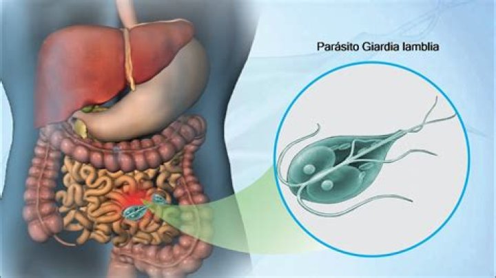 What is Giardia lamblia AG?