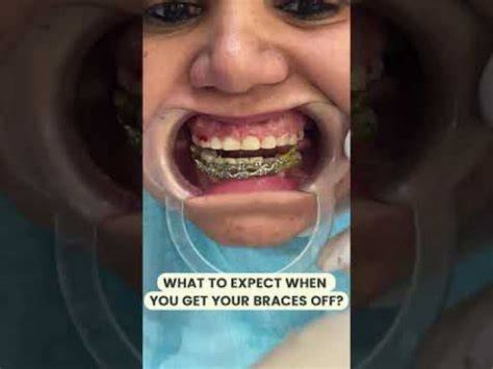Why do teeth feel slimy after braces?