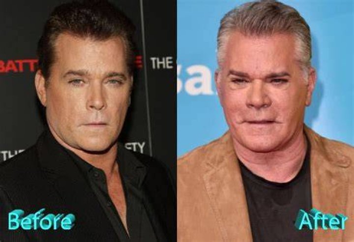 Why does Ray Liotta wear eyeliner? Ray Liotta eyeliner, plastic surgery explained |