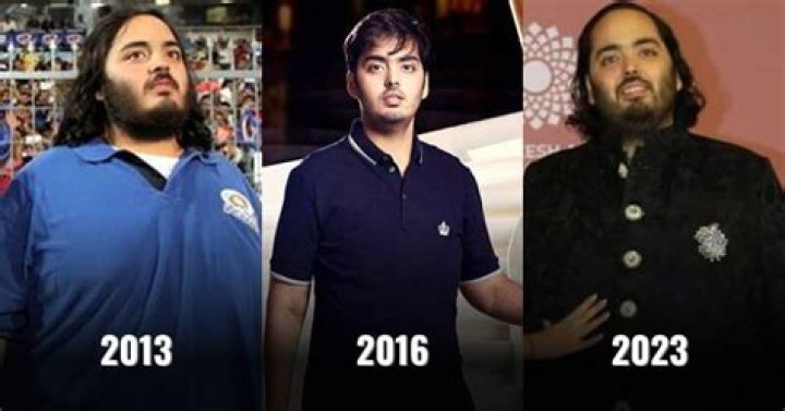 Why is Anant Ambani So Fat? Medical Condition Explained