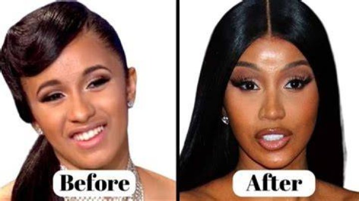 Yodit Yemane Before Plastic Surgery
