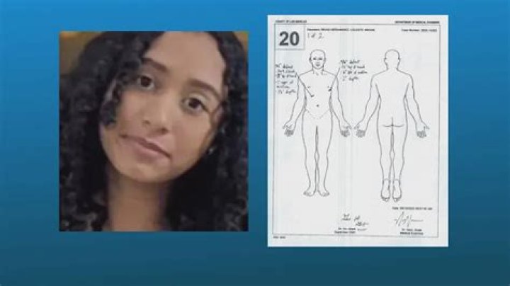 Zaria Burgess Autopsy Report Reveals Startling Discoveries